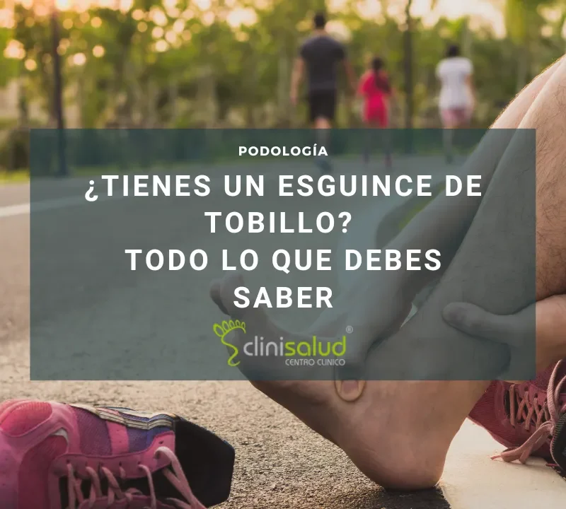 Tengo un esguince de tobillo