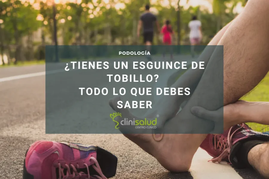 Tengo un esguince de tobillo