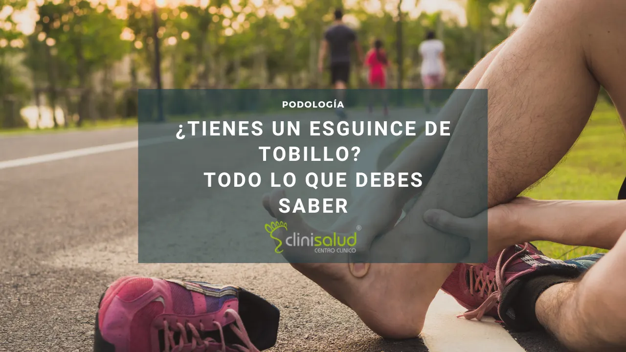 Tengo un esguince de tobillo