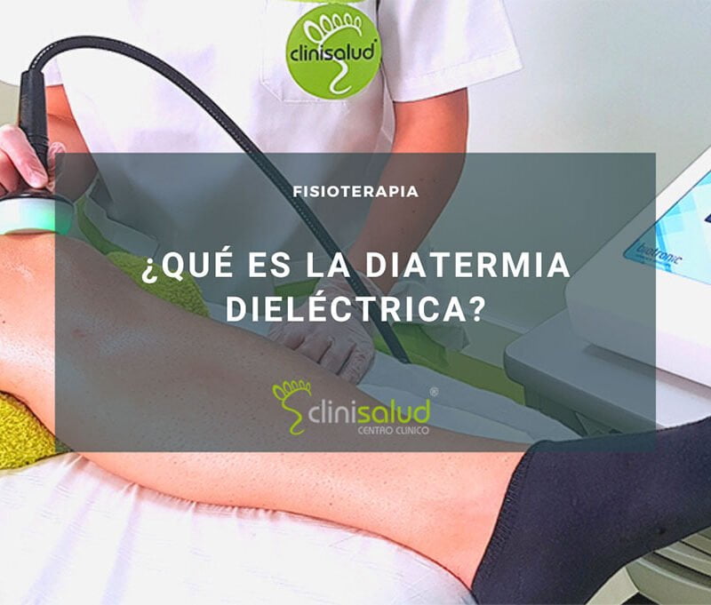 Diatermia dieléctrica