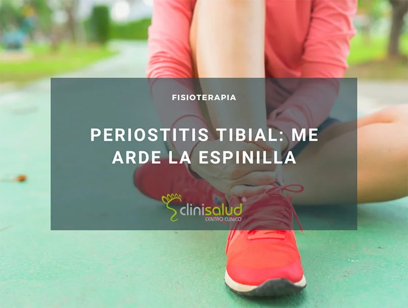 Periostitis tibial: me arde la espinilla