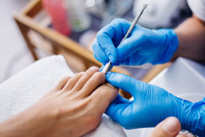 uñas quimioterapia