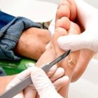 Servicio de quiropodia | Clinisalud