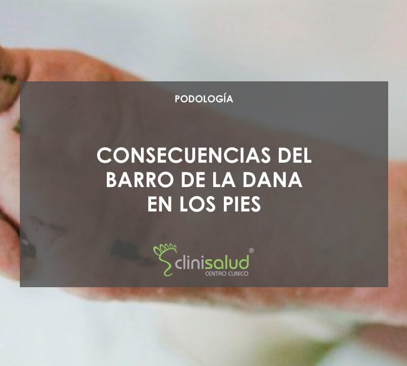 Consecuencias del barro de la DANA en los pies