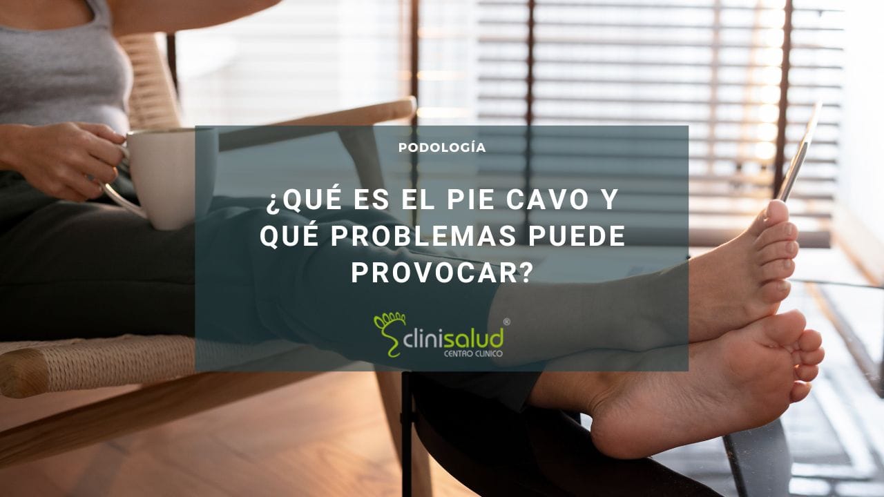 Pie Cavo | Clinisalud