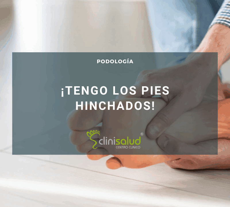 Mujer pies hinchados