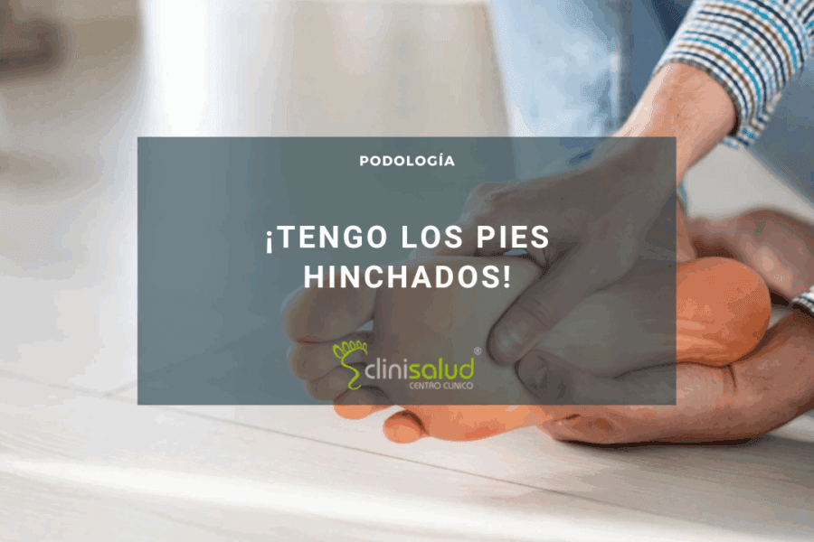 Mujer pies hinchados