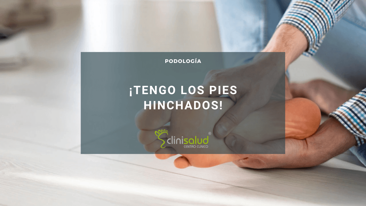 Mujer pies hinchados