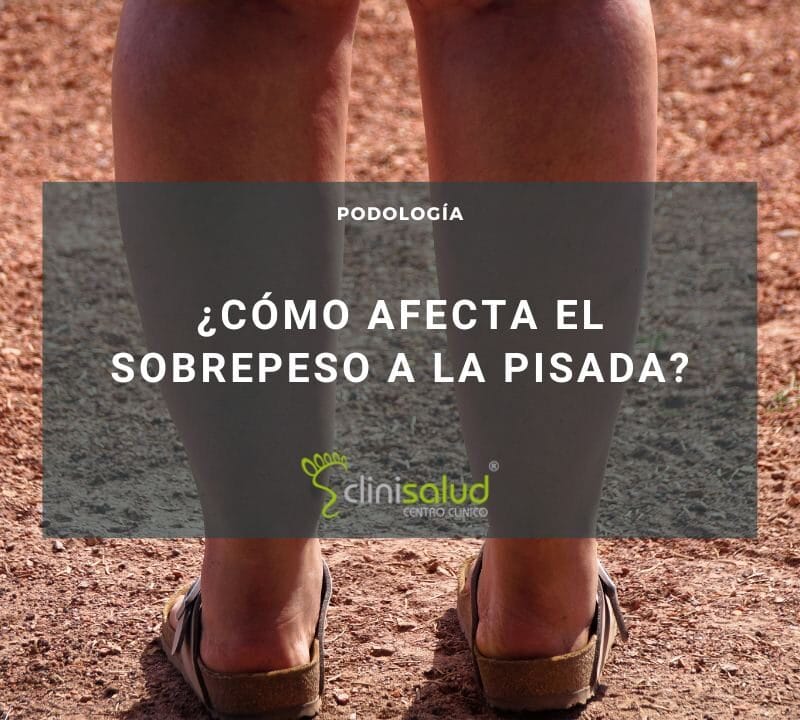 Sobrepeso pisada mujeres