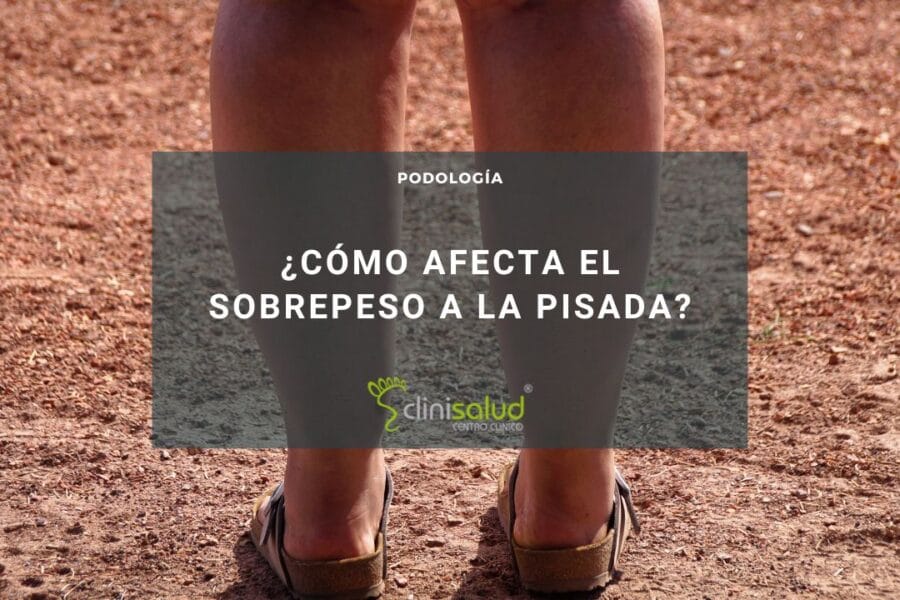 Sobrepeso pisada mujeres