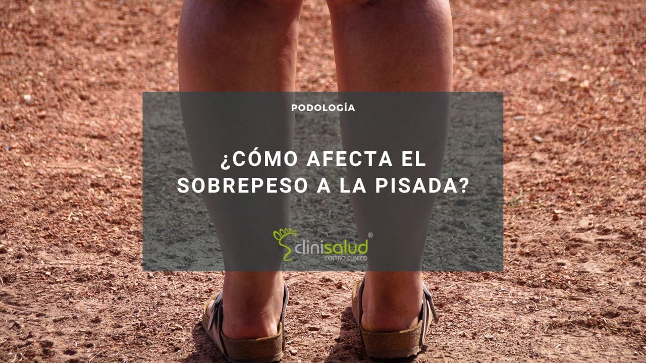 Sobrepeso pisada mujeres