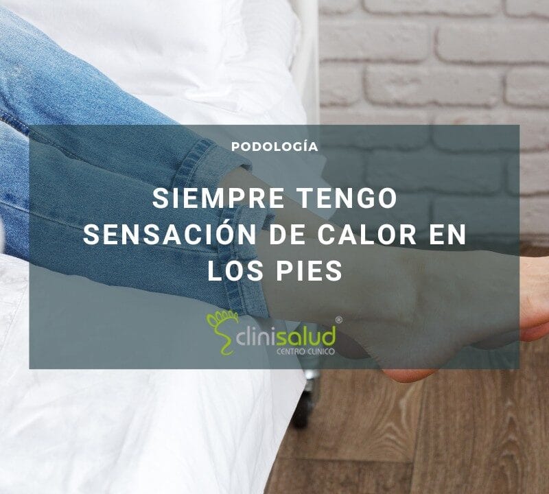 Sensación de calor en el pie sin dolor
