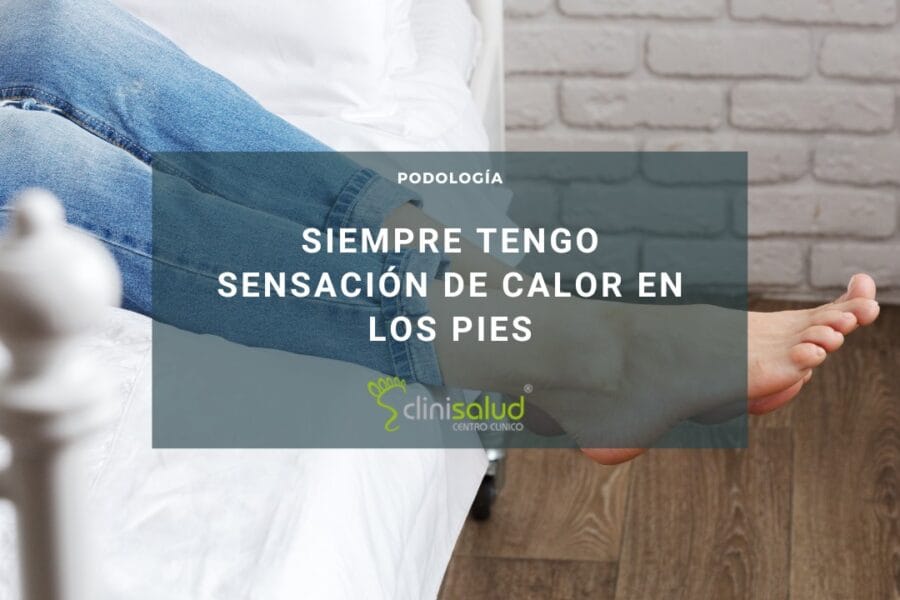 Sensación de calor en el pie sin dolor