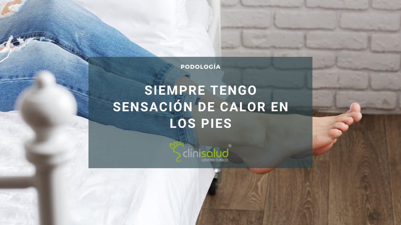 Sensación de calor en el pie sin dolor