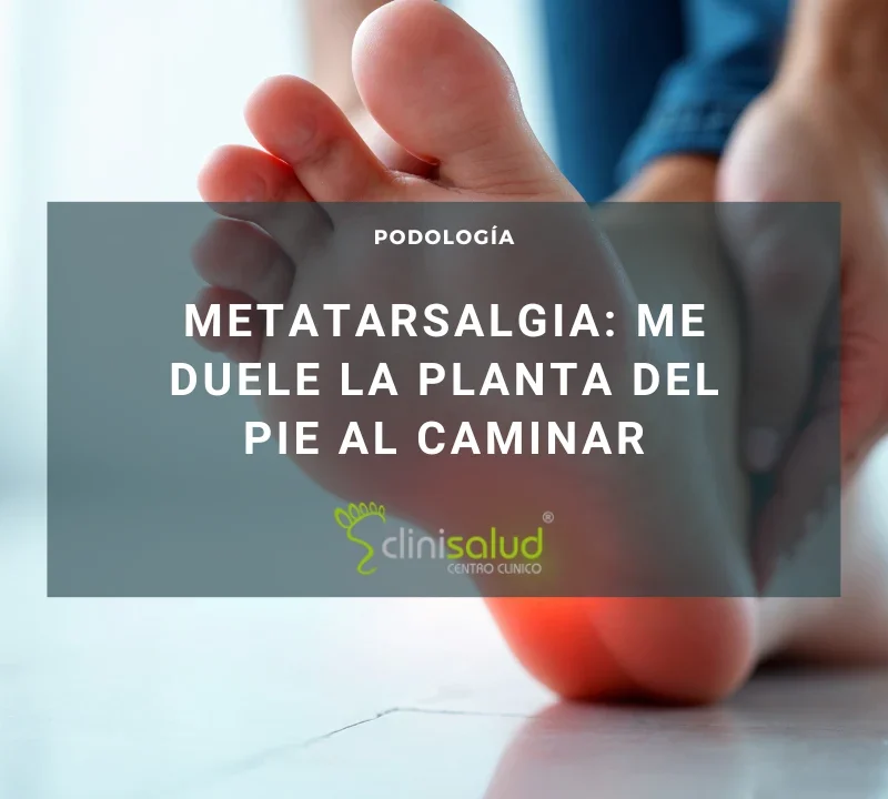 METATARSALGIA podología