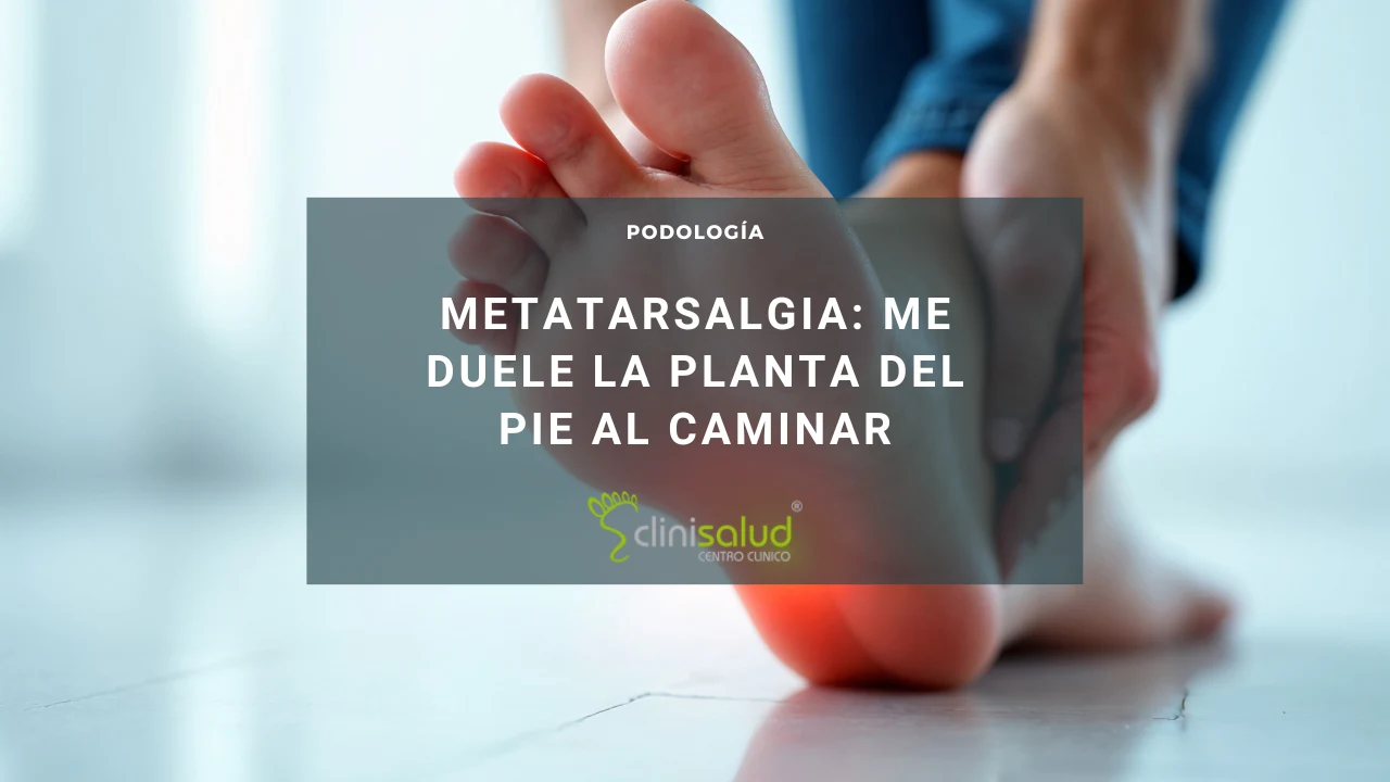 METATARSALGIA podología