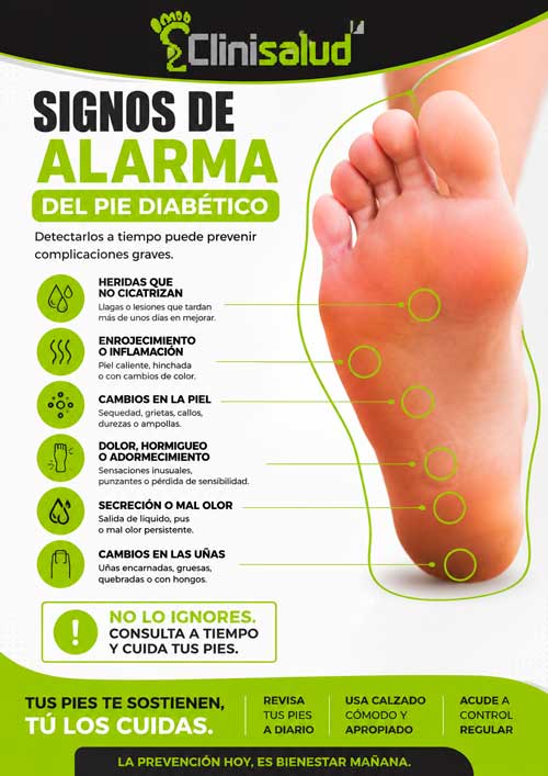 Si eres diabético, tu pie te avisa y te da señales de alarma. Te explicamos cuáles.