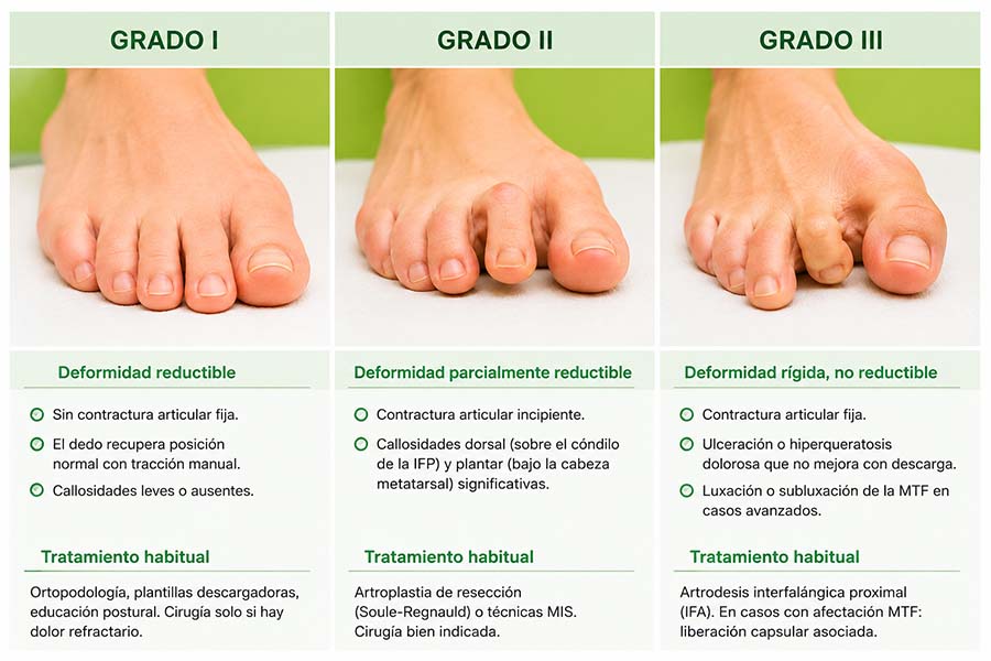 Grados y clasificación de las deformidades digitales por el Dr. Soriano