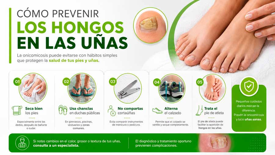 El podólogo Alfredo Soriano explica cómo prevenir los hongos en las uñas