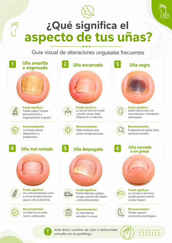 que significa el aspecto de tus unas