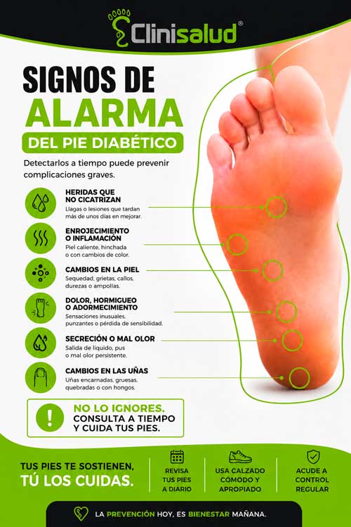 Síntomas de alarma del pie diabético