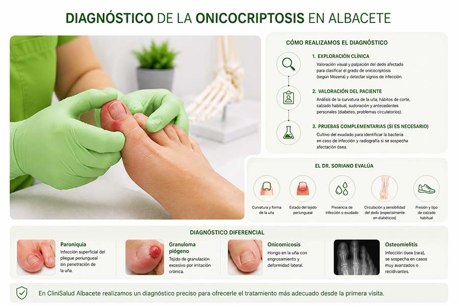 Diagnóstico de la onicocriptosis en Clinisalud, Albacete