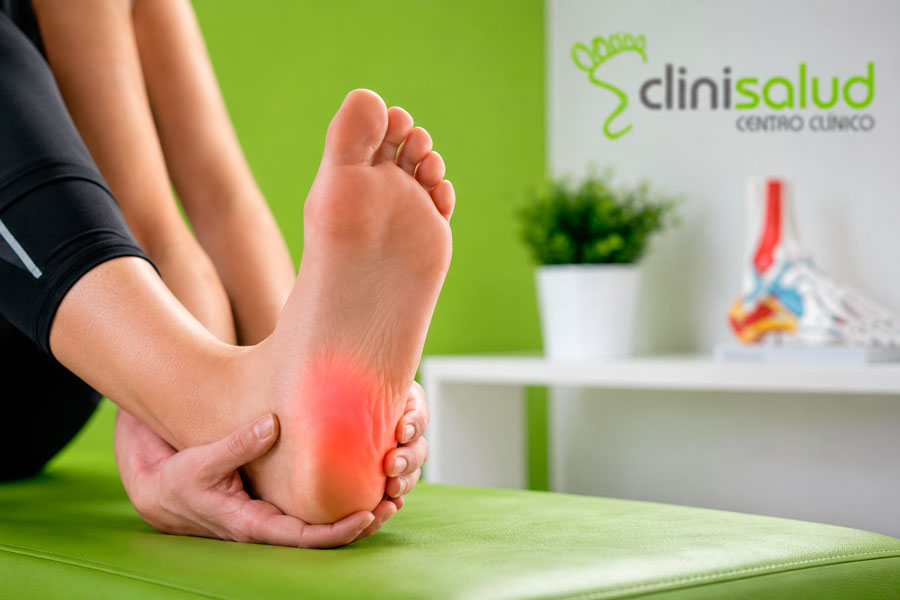 Dolor por fascitis plantar en deportistas y corredores qué es, causas y síntomas