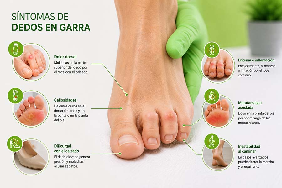 Síntomas de dedos en garra