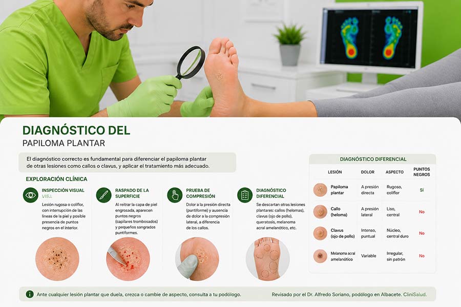 Podólogo realizando el diagnóstico de un papiloma plantar mediante exploración clínica, desbridamiento y dermatoscopia en Albacete.
