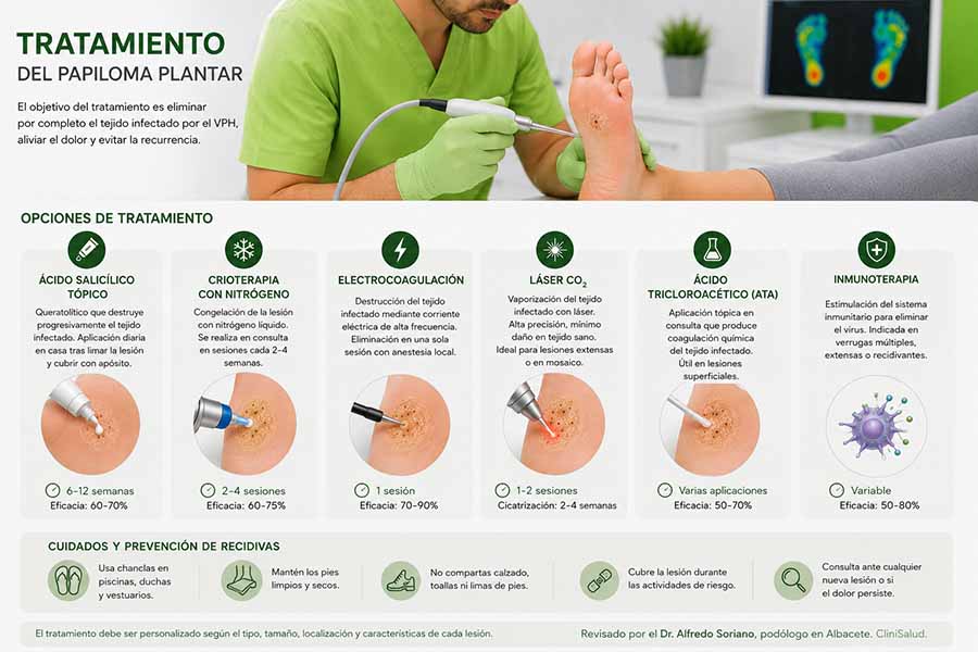 Tratamiento del papiloma plantar mediante técnicas podológicas avanzadas como crioterapia, ácido salicílico, láser y electrocoagulación en Albacete.