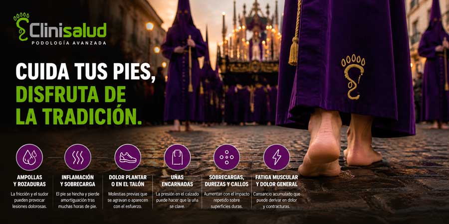 El pie de nazareno