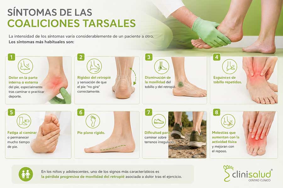 Infografía sobre los síntomas de las coaliciones tarsales con imágenes clínicas de dolor, rigidez, limitación de movilidad, esguinces repetidos, pie plano rígido y dificultad para caminar.