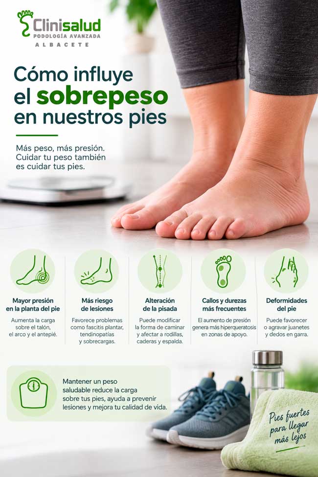 Infografía sobre cómo influye el sobrepeso en la presión y las molestias de los pies