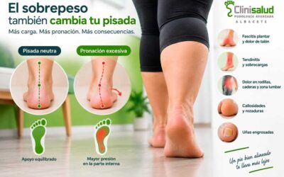 Cómo afecta el sobrepeso a tus pies y a tu pisada
