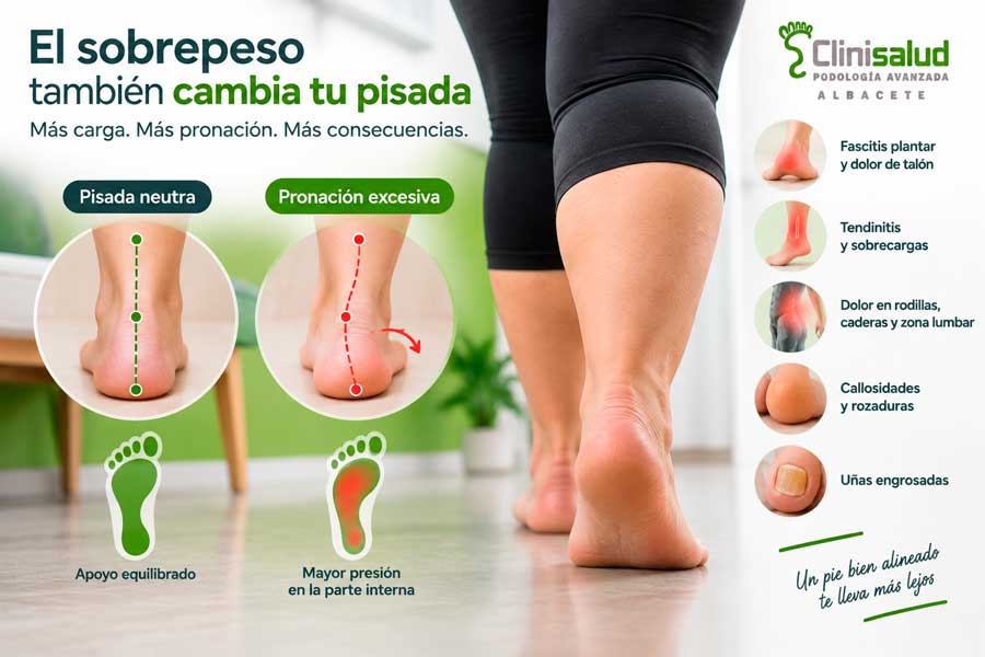 Infografía que compara una pisada neutra con una pronación y muestra posibles molestias asociadas al sobrepeso