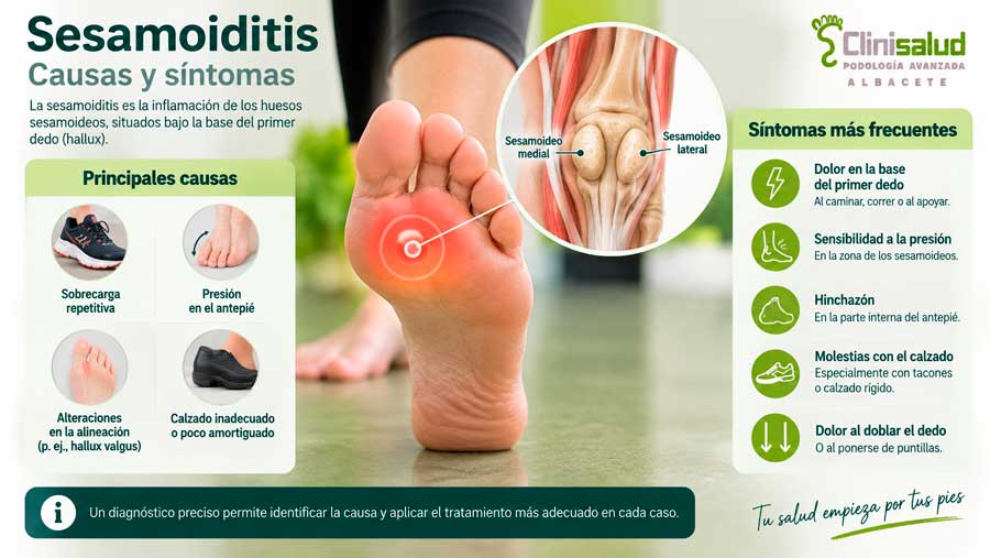 Infografía de los sesamoideos bajo el dedo gordo, las causas y los síntomas de la sesamoiditis