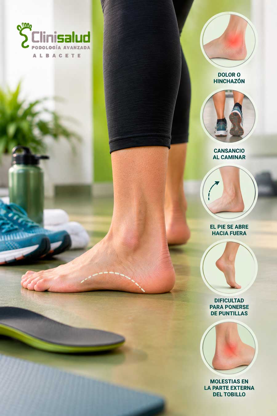Infografía de los síntomas del pie plano adulto: dolor e hinchazón, cansancio al caminar, arco que se aplana, dificultad para ponerse de puntillas y molestias en la parte interna del tobillo
