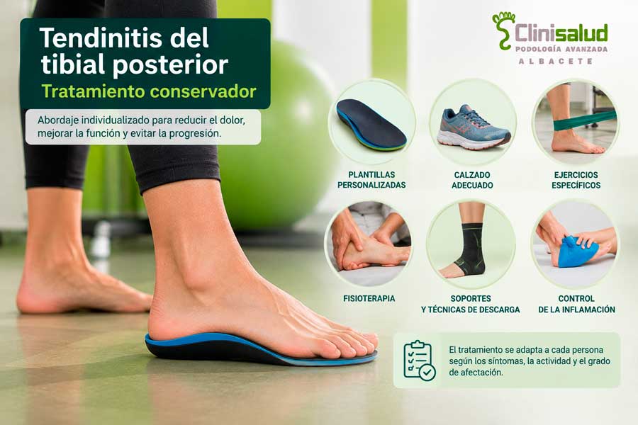 Tratamiento de la tendinitis del tibial posterior